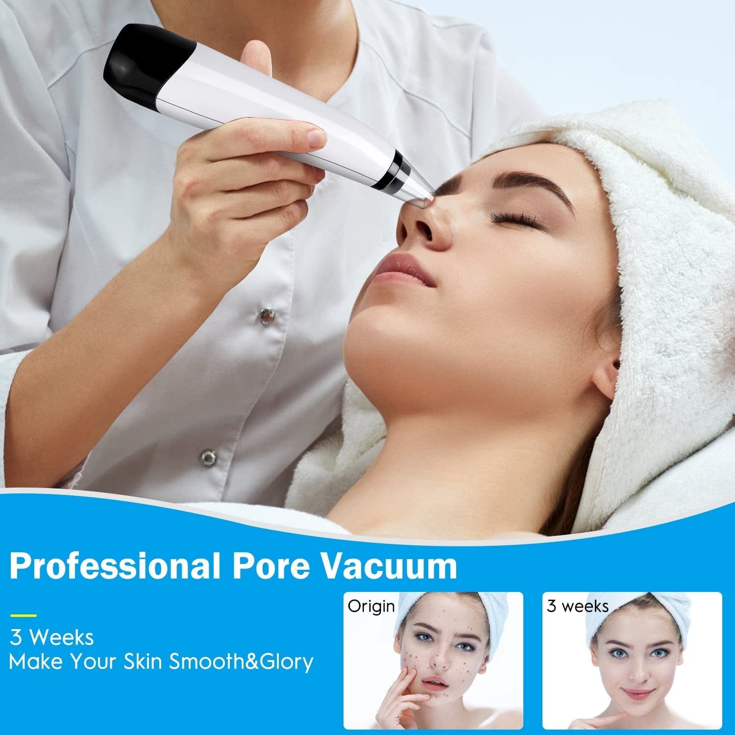 2022 New Version Blackhead Vacuum Remover Acne Remover,Facial Pore Cleanser Electric Acne Comedone, 6 Adjustable Suction Power, USB Rechargeable, Blackhead Extractor Tool Health & Beauty > Personal Care > Cosmetics > Cosmetic Tools > Skin Care Tools Musment   