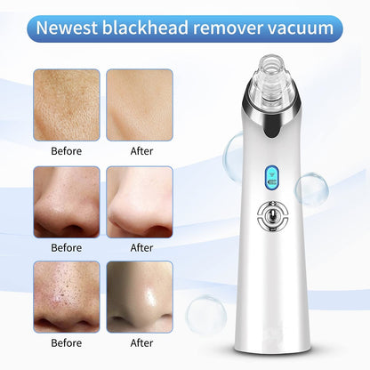 2022 Newest Blackhead Remover Pore Vacuum Electric Blackhead Removal Tool Health & Beauty > Personal Care > Cosmetics > Cosmetic Tools > Skin Care Tools BPZZ   