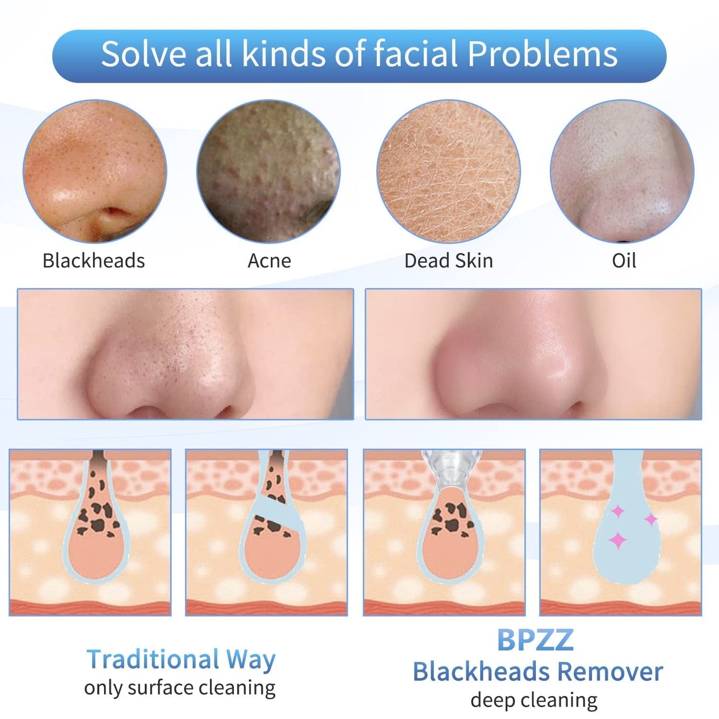 2022 Newest Blackhead Remover Pore Vacuum Electric Blackhead Removal Tool Health & Beauty > Personal Care > Cosmetics > Cosmetic Tools > Skin Care Tools BPZZ   