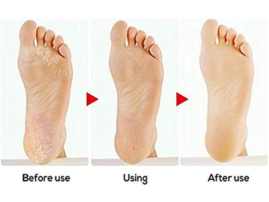 Foot Scrubber Foot File Callus Remover, ESARORA Double-Sided Pedicure Tools Foot Care Pedicure to Remove Hard Skin (Pack of 4) Health & Beauty > Personal Care > Foot Care ESARORA   