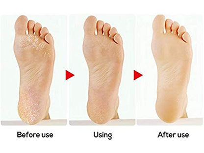 Foot Scrubber Foot File Callus Remover, ESARORA Double-Sided Pedicure Tools Foot Care Pedicure to Remove Hard Skin (Pack of 4) Health & Beauty > Personal Care > Foot Care ESARORA   