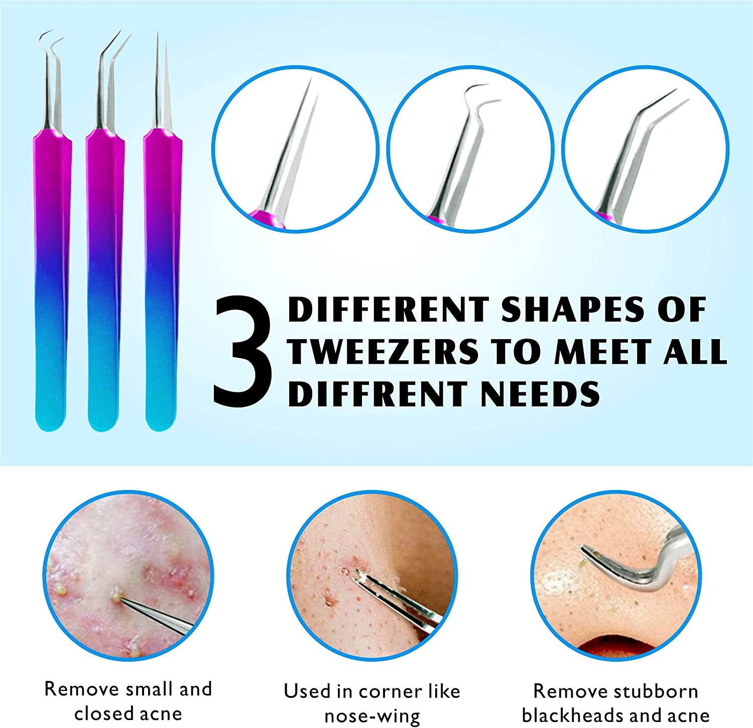 Blackhead Remover Extractor Tool, Ybaoo 10 Pcs Professional Surgical Pimple Popper Tool Kit with Metal Case for Quick and Easy Removal of Blackheads,Pimples,Zit Removing,Facial and Nose(Colorful) Health & Beauty > Personal Care > Cosmetics > Cosmetic Tools > Skin Care Tools Ybaoo   