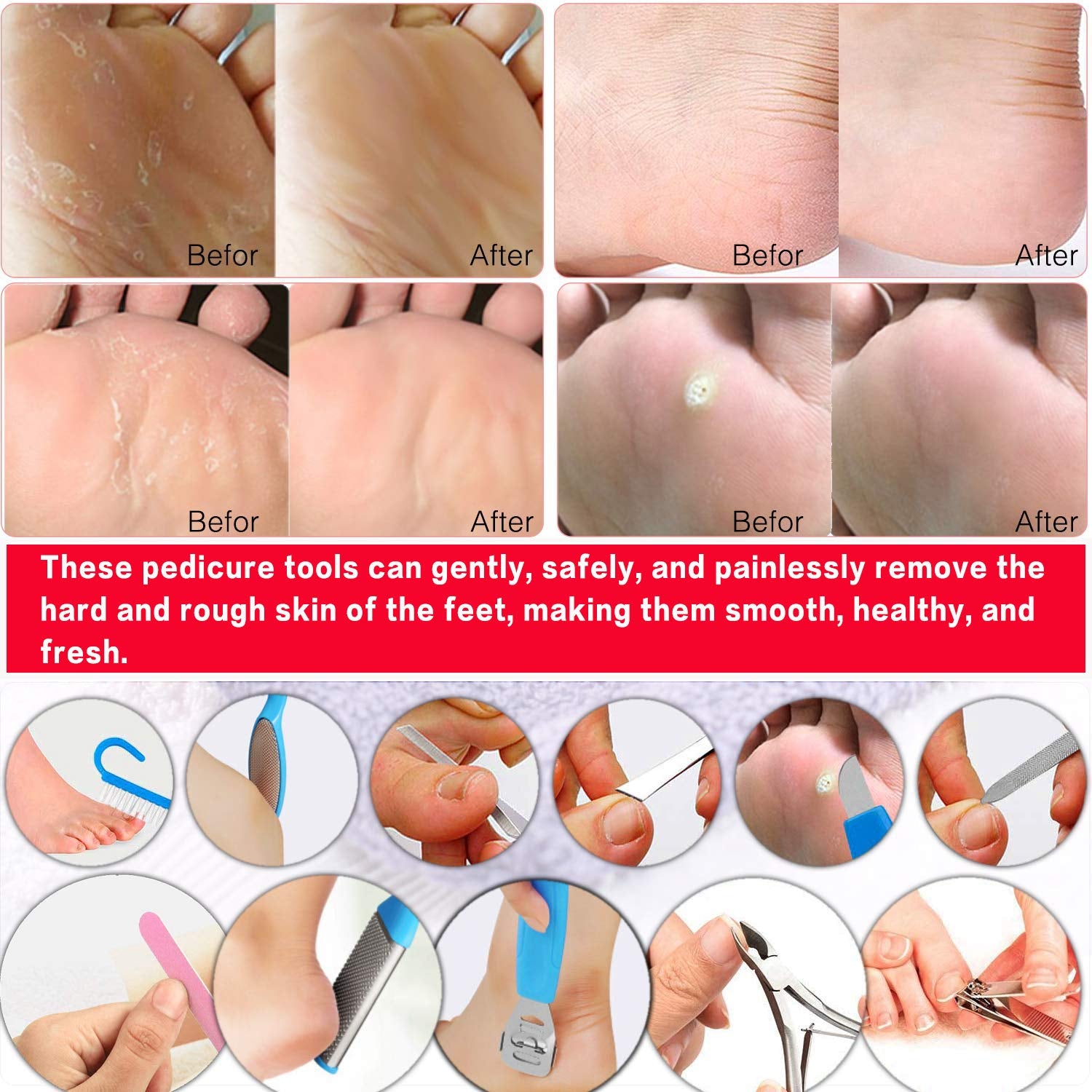 Pedicure Kit Professional Manicure and Pedicure Tools Supplies Set 16 Pieces Foot Care Kit Feet Set for Women Men Health & Beauty > Personal Care > Foot Care N&A   