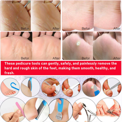 Pedicure Kit Professional Manicure and Pedicure Tools Supplies Set 16 Pieces Foot Care Kit Feet Set for Women Men Health & Beauty > Personal Care > Foot Care N&A   