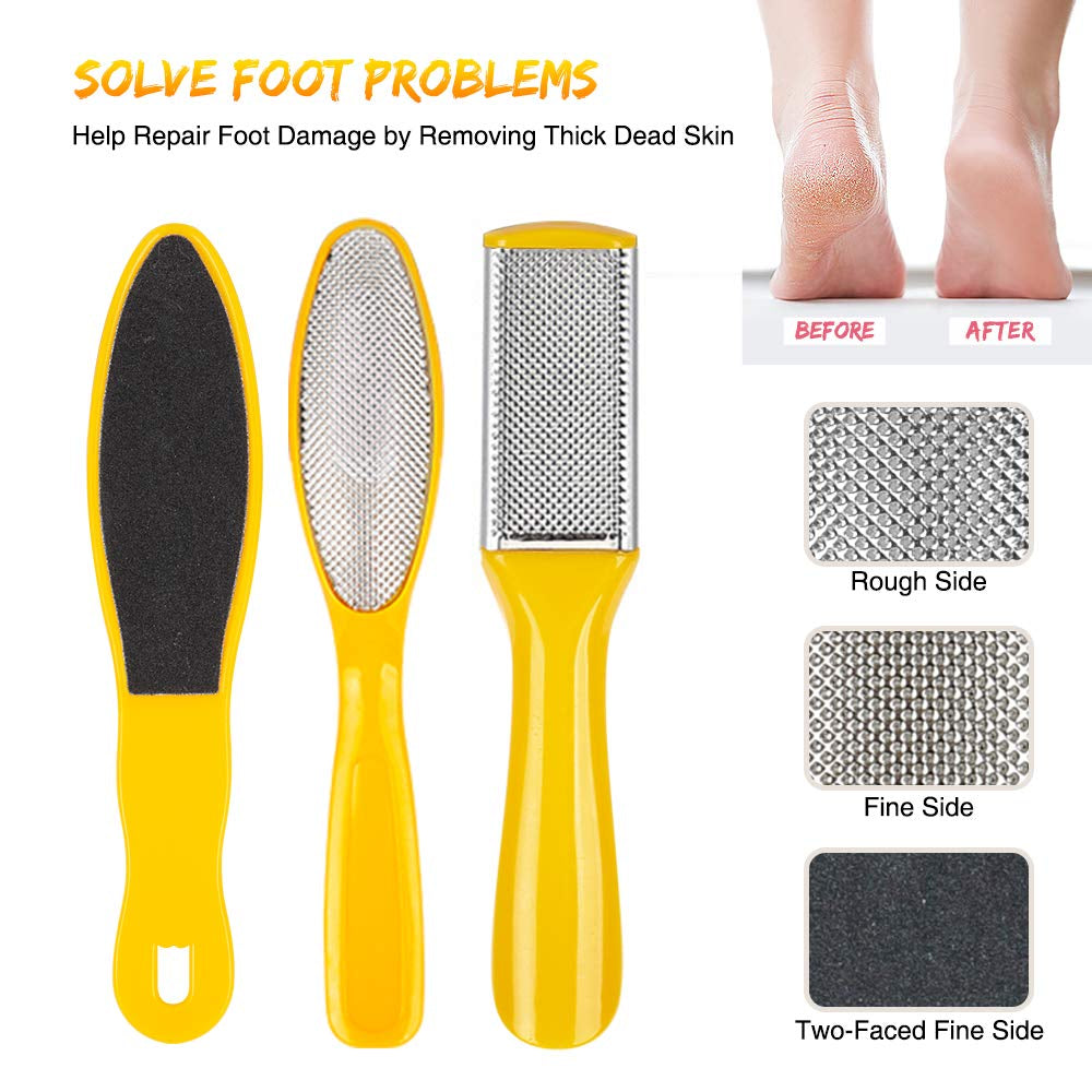 Pedicure Kit for Women, 20 in 1 Foot Care Pedicure Kit Stainless Steel, Foot Files Set with Nail Scrub Double Sided Files Foot Care for Women, Men, Home and Salon Health & Beauty > Personal Care > Foot Care LINCEDY   