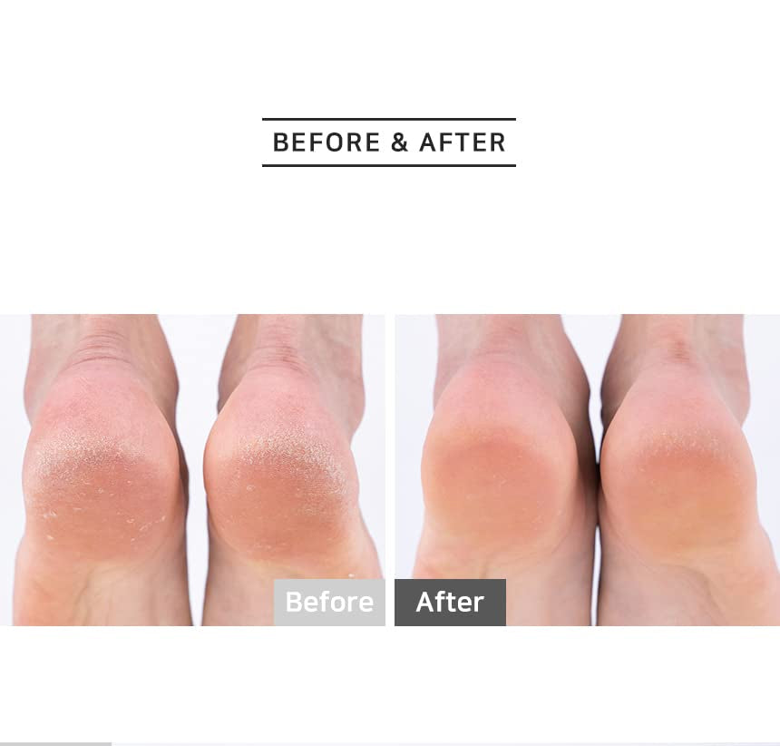 RUBELLI MOISTURIZING FOOT PEEL MASK : [1PACK] Callus Remover for Soft Foot Only 20Minutes, Nourishes Your Feet and Dried Heels Health & Beauty > Personal Care > Foot Care RuBelli   