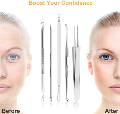 Pimple Popper Tool Kit, UUBAAR 9 PCS Blackhead Remover Tools with Tweezers, 16-Heads Professional Acne Zit Popper Extraction Tools, Whitehead Comedone Pimple Popping Extractor Kit for Facial Nose Health & Beauty > Personal Care > Cosmetics > Cosmetic Tools > Skin Care Tools UUBAAR   