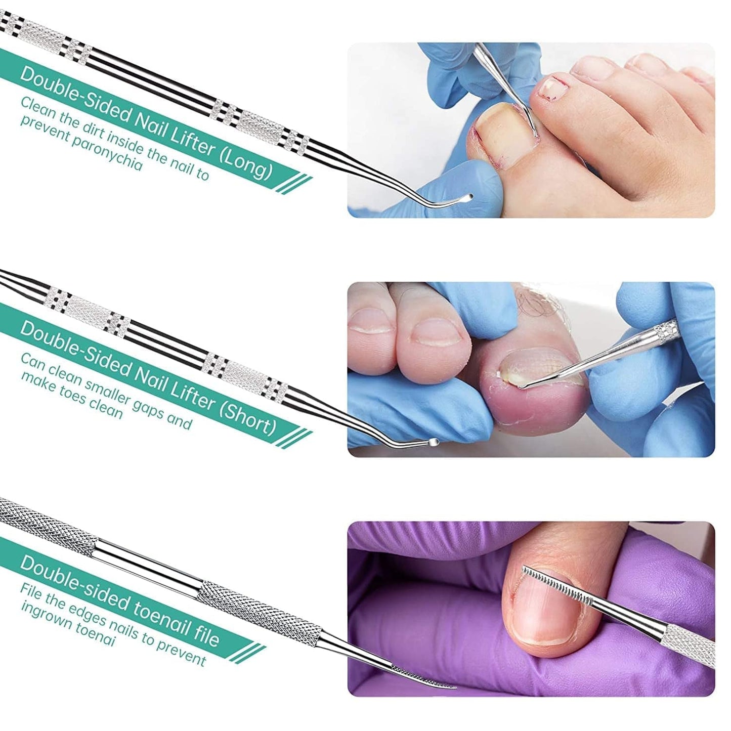 3-Pack Ingrown Toenail File and Lifters, Professional Surgical Stainless Steel Ingrown Toenail Tool- Safe Nail Cleaning Treatment Pedicure Tools Kit under Sidewall Cleaner Pain Relief Accessories Health & Beauty > Personal Care > Cosmetics > Cosmetic Tools > Nail Tools POLKASTORE   