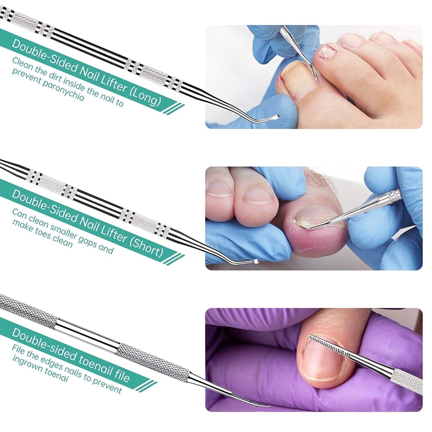 3-Pack Ingrown Toenail File and Lifters, Professional Surgical Stainless Steel Ingrown Toenail Tool- Safe Nail Cleaning Treatment Pedicure Tools Kit under Sidewall Cleaner Pain Relief Accessories Health & Beauty > Personal Care > Cosmetics > Cosmetic Tools > Nail Tools POLKASTORE   