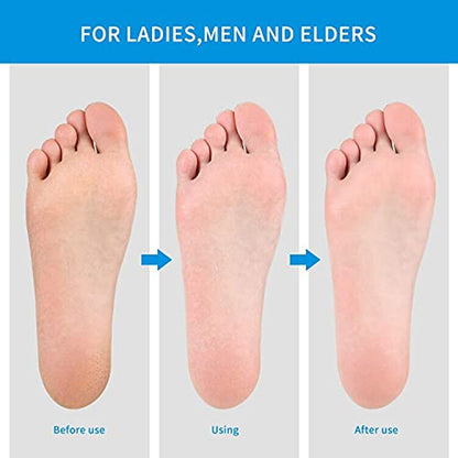 Dr.Nail Callus Remover for Feet Professional Colossal Foot Rasp and Stainless Steel Foot Flie Scrubber Pedicure Tool to Foot Care Remove Hard Skin Can Be Used to Wet and Dry Feet (Large) Health & Beauty > Personal Care > Foot Care Dr.nail   