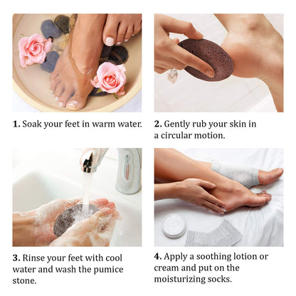 Pumice Stone for Feet & Moisturizing Heel Sleeves - Natural Lava Foot Stone Callus Removing Set - Cracked Heel Treatment - Foot Care Kit for Dry Cracked Feet Body Hands (Brown) (Brown) Health & Beauty > Personal Care > Foot Care Pumice Valley   