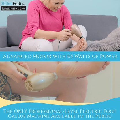 30Secpedi by Renbach | Electric Callus Remover for Feet, Heels & Hands | Foot File Scraper, Electronic Sander, Provides Care for Dry, Dead, Hard, Tough, Cracked Skin, Gives Soft Comfortable Feet Health & Beauty > Personal Care > Foot Care 30SecPedi   