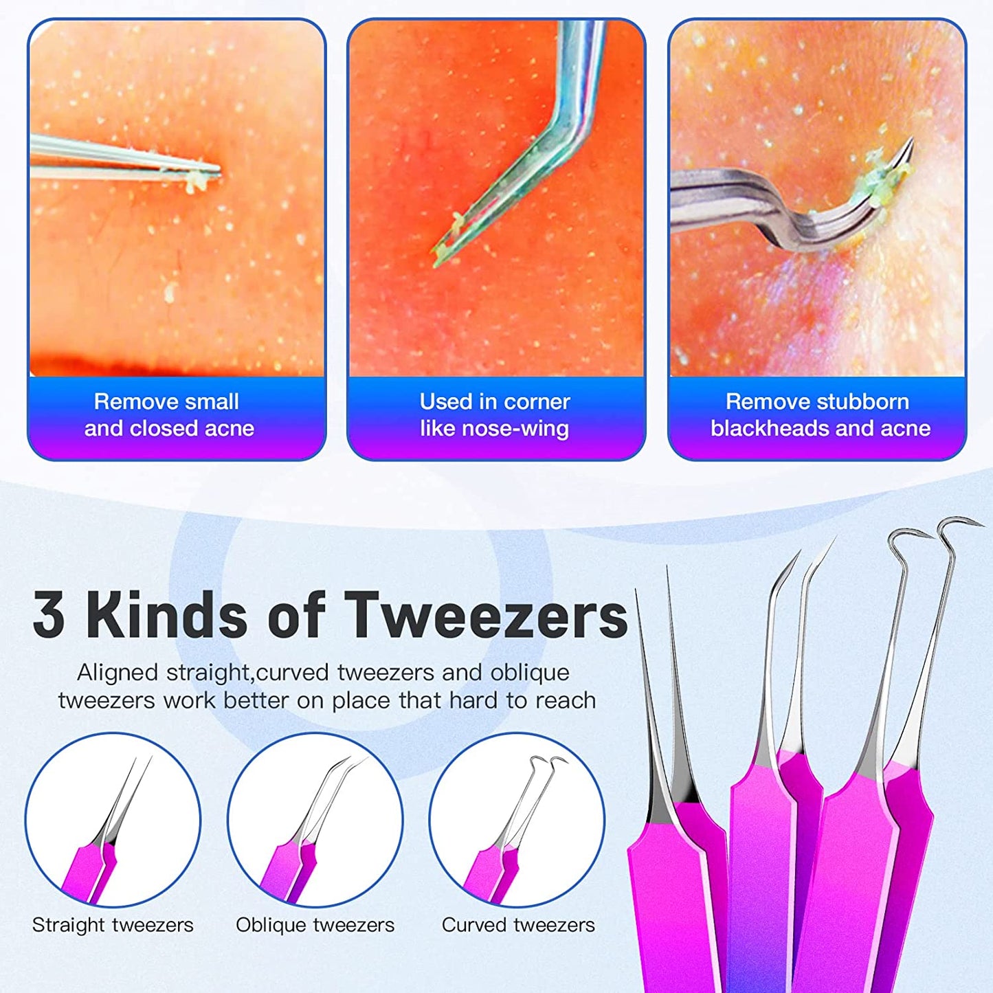 Pimple Popper Tool Kit, Rezhy 10 Pcs Blackhead Remover Comedone Extractor, Pimple Extractors Blackhead Extractor Kit for Acne Blemish Removal with Metal Case (Multicolor) Health & Beauty > Personal Care > Cosmetics > Cosmetic Tools > Skin Care Tools Rezhy   