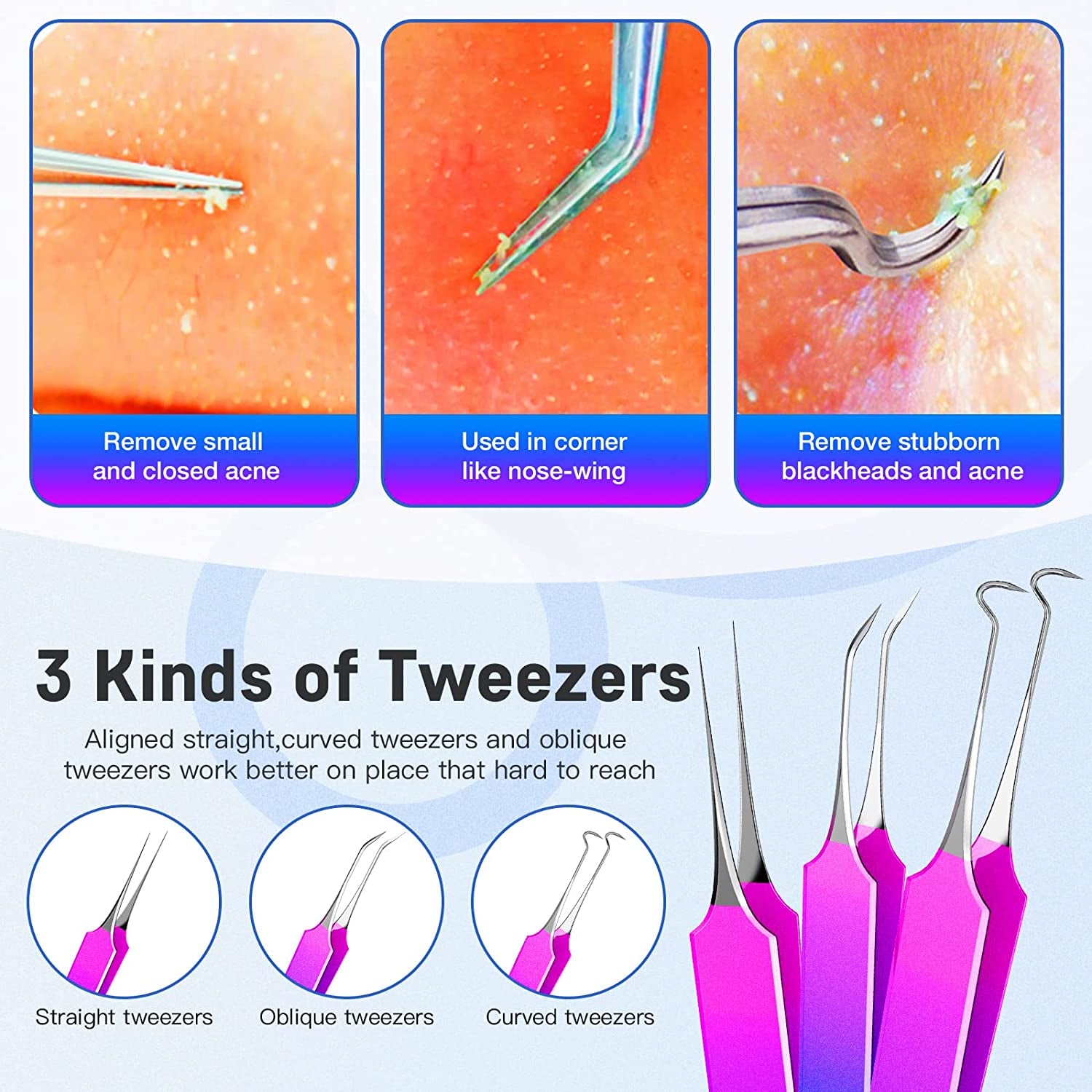 Pimple Popper Tool Kit, Rezhy 10 Pcs Blackhead Remover Comedone Extractor, Pimple Extractors Blackhead Extractor Kit for Acne Blemish Removal with Metal Case (Multicolor) Health & Beauty > Personal Care > Cosmetics > Cosmetic Tools > Skin Care Tools Rezhy   