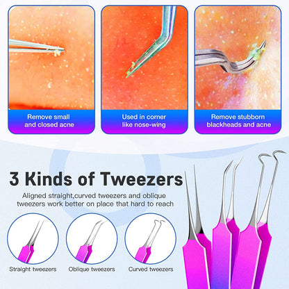 Pimple Popper Tool Kit, Rezhy 10 Pcs Blackhead Remover Comedone Extractor, Pimple Extractors Blackhead Extractor Kit for Acne Blemish Removal with Metal Case (Multicolor) Health & Beauty > Personal Care > Cosmetics > Cosmetic Tools > Skin Care Tools Rezhy   