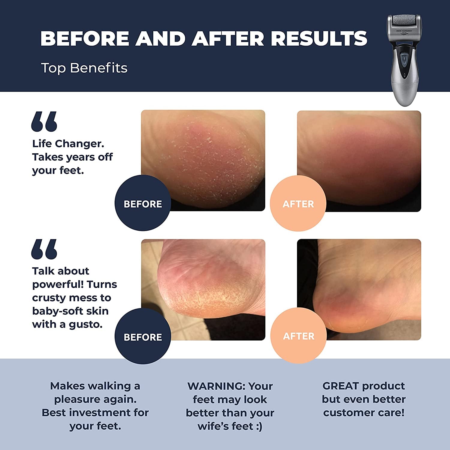 Electric Foot Callus Remover, Feet Scrubber: Own Harmony Rechargeable Mens Pedicure Tools Kit, Professional Electronic Foot Care File, Best for Hard Cracked Dead Skin and Powerful Pedi Spa, 3 Rollers Health & Beauty > Personal Care > Foot Care Own Harmony   