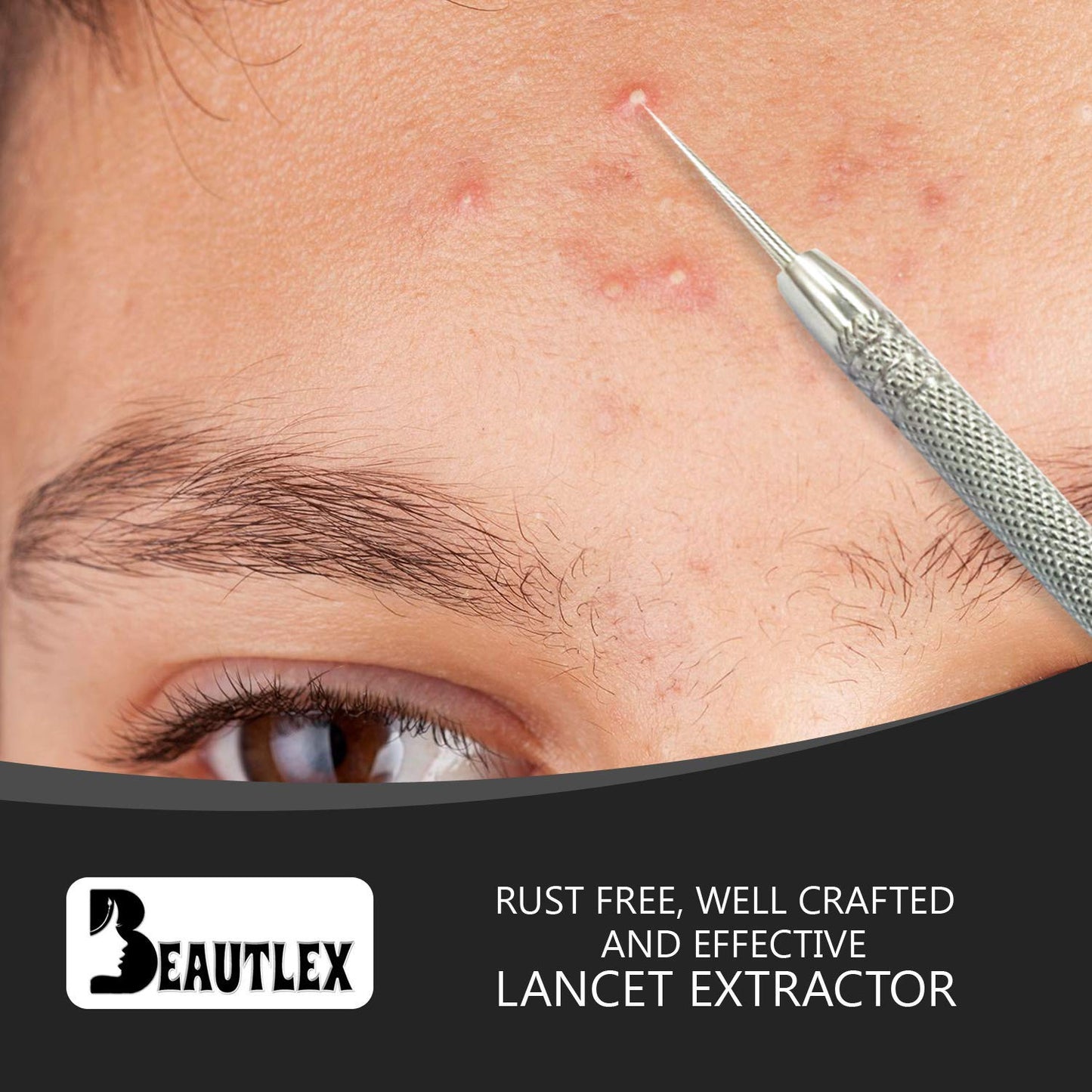 Lancet for Facial Milia Remover and Whitehead Extractor. Double Ended Angled Circle Loop & Sharp Needle Pimple Popper Tool. Dermatologists Recommended Design and Comes with Synthetic Leather Storage Health & Beauty > Personal Care > Cosmetics > Cosmetic Tools > Skin Care Tools Beautlex   