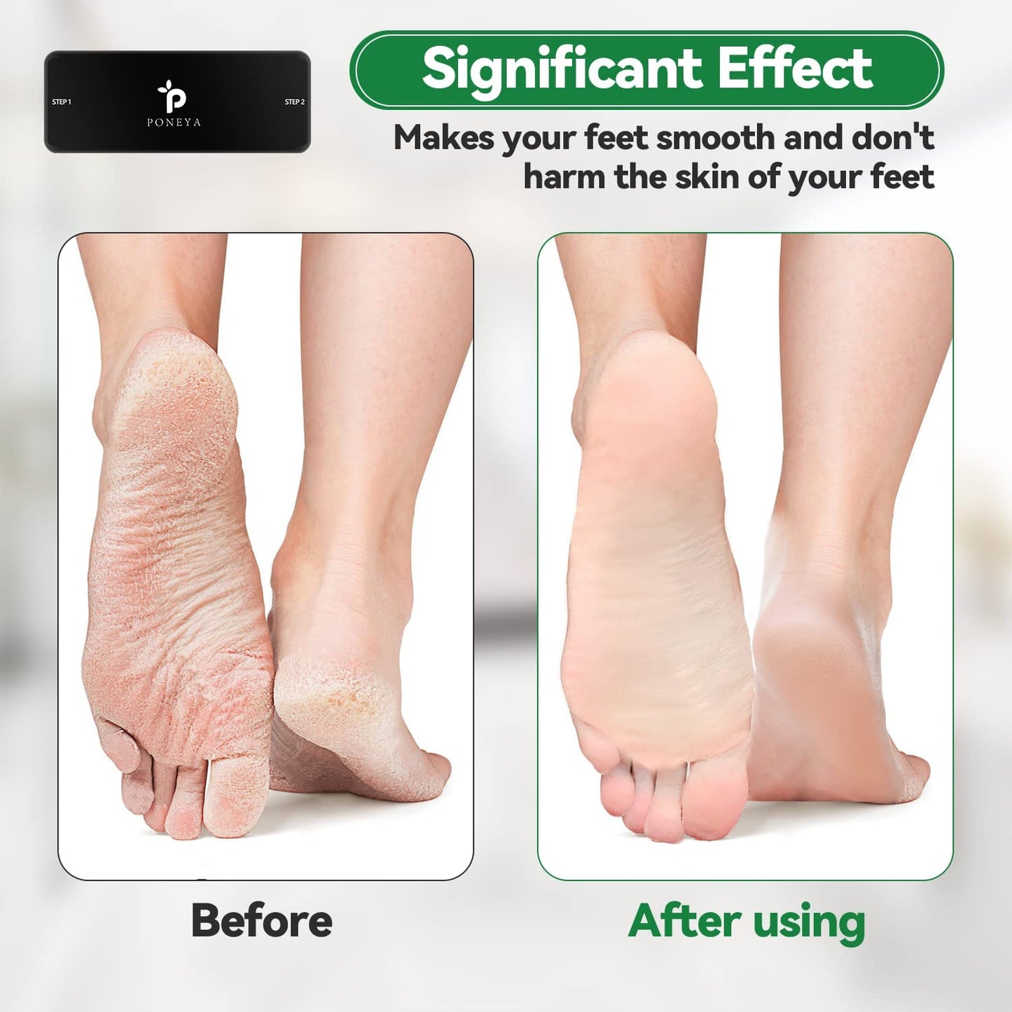 Foot File-Nano Glass Foot File Callus Remover for Feet, Best Foot Care Pedicure Tools Foot Scrubber to Remove Dead or Hard Cracked Dry Skin, Foot Scraper for Soft Feet, for Men Women Travel (Black) Health & Beauty > Personal Care > Foot Care PONEYA   