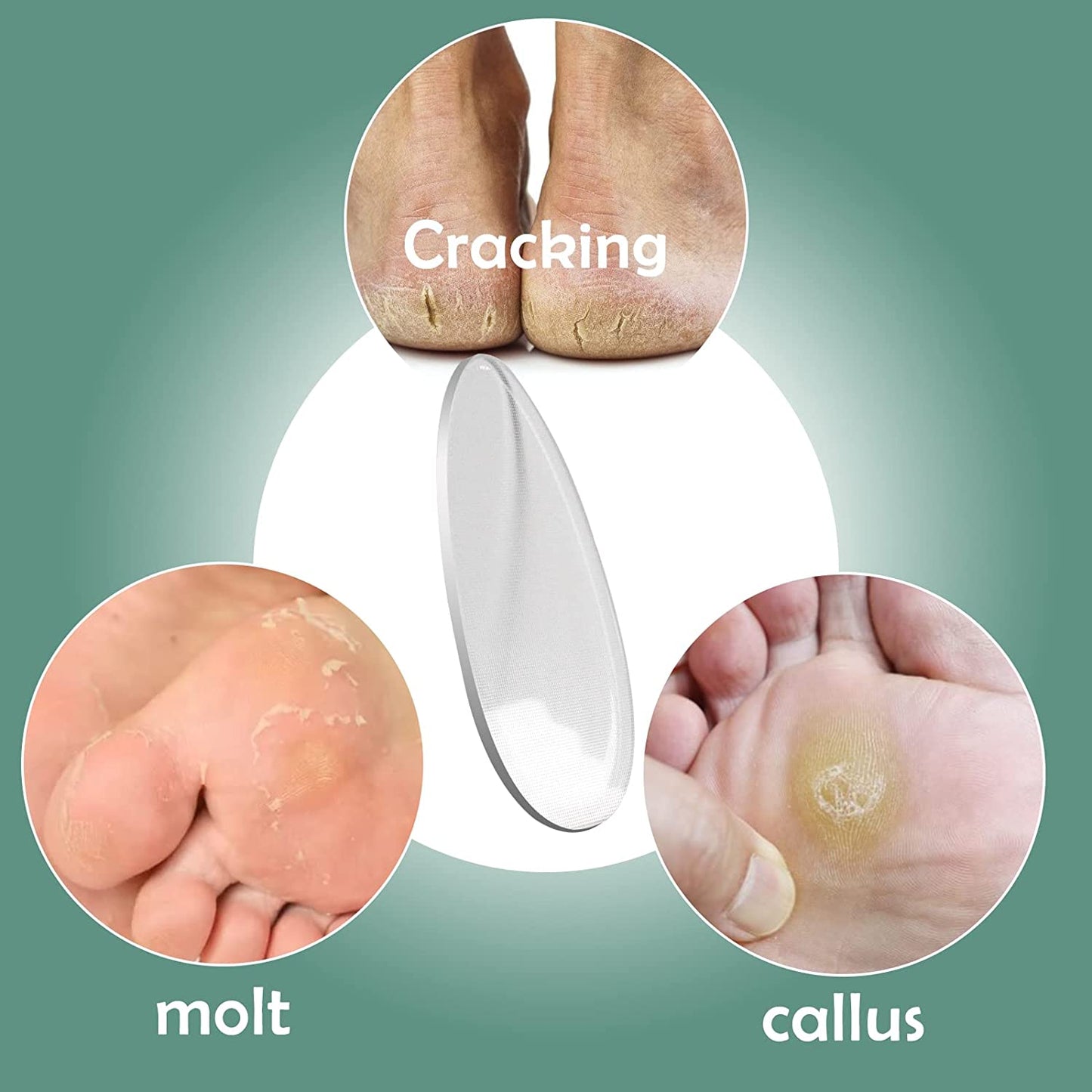 Redflow Glass Foot File,Nano Foot Scrubber Callus Remover, Foot Care Pedicure Tool,Foot File with Nano-Level Grinding Points, Great for Dead Skin Removal, Cracking, Wet and Dry Feet Health & Beauty > Personal Care > Foot Care RedFlow   