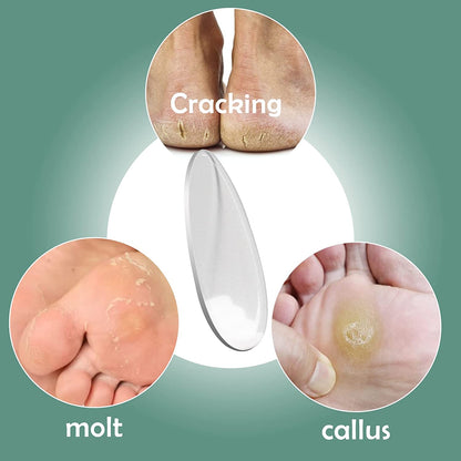 Redflow Glass Foot File,Nano Foot Scrubber Callus Remover, Foot Care Pedicure Tool,Foot File with Nano-Level Grinding Points, Great for Dead Skin Removal, Cracking, Wet and Dry Feet Health & Beauty > Personal Care > Foot Care RedFlow   