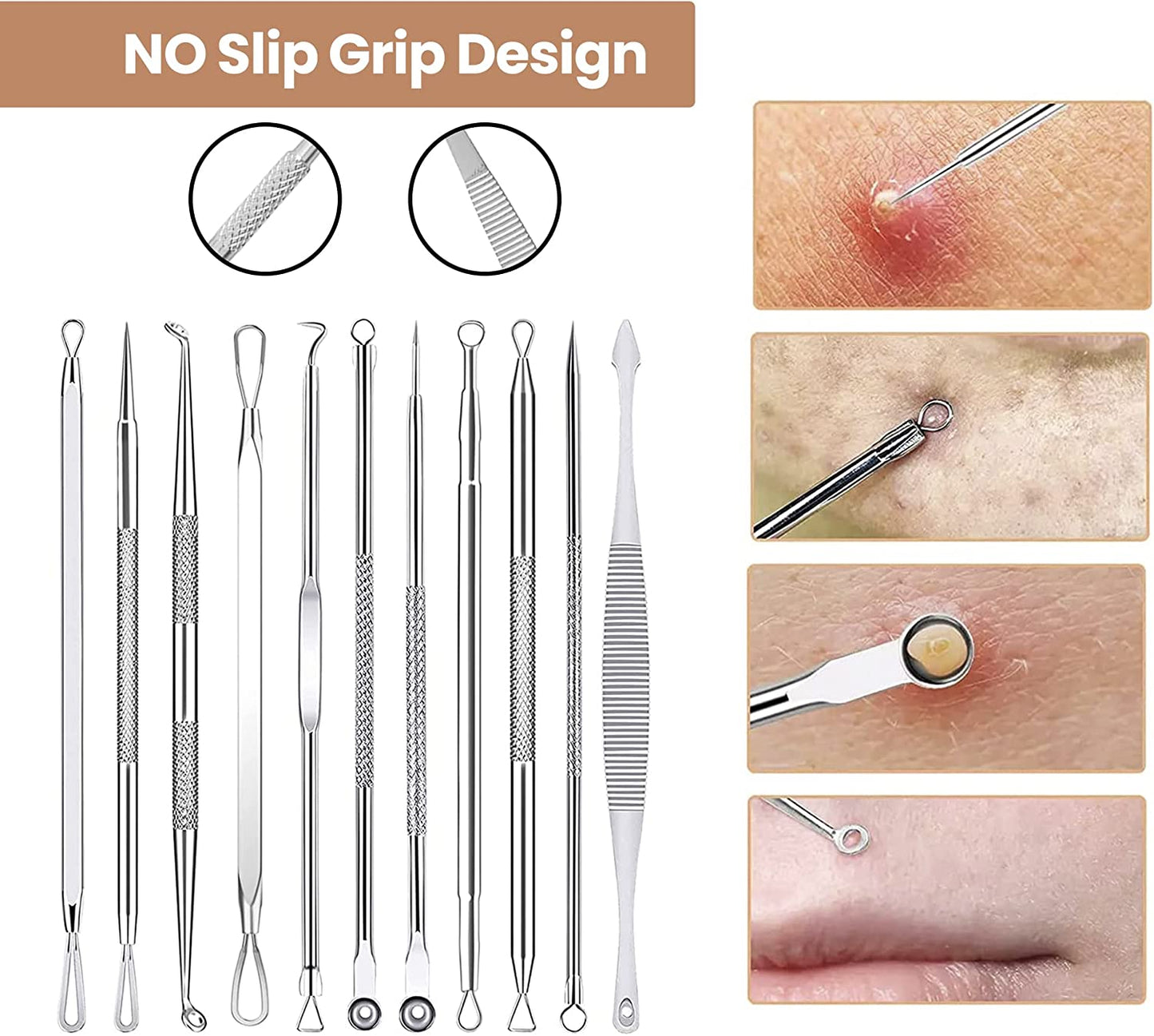 Dermated [16 Pack] Blackhead Remover Tools Pimple Popper Tool Kit | Stainless Steel Professional Pimple Extractor Tool Kit for Blackheads, Blemish, Comdone, Acne, Zit, and Whiteheads for Face & Nose Health & Beauty > Personal Care > Cosmetics > Cosmetic Tools > Skin Care Tools DERMATED   