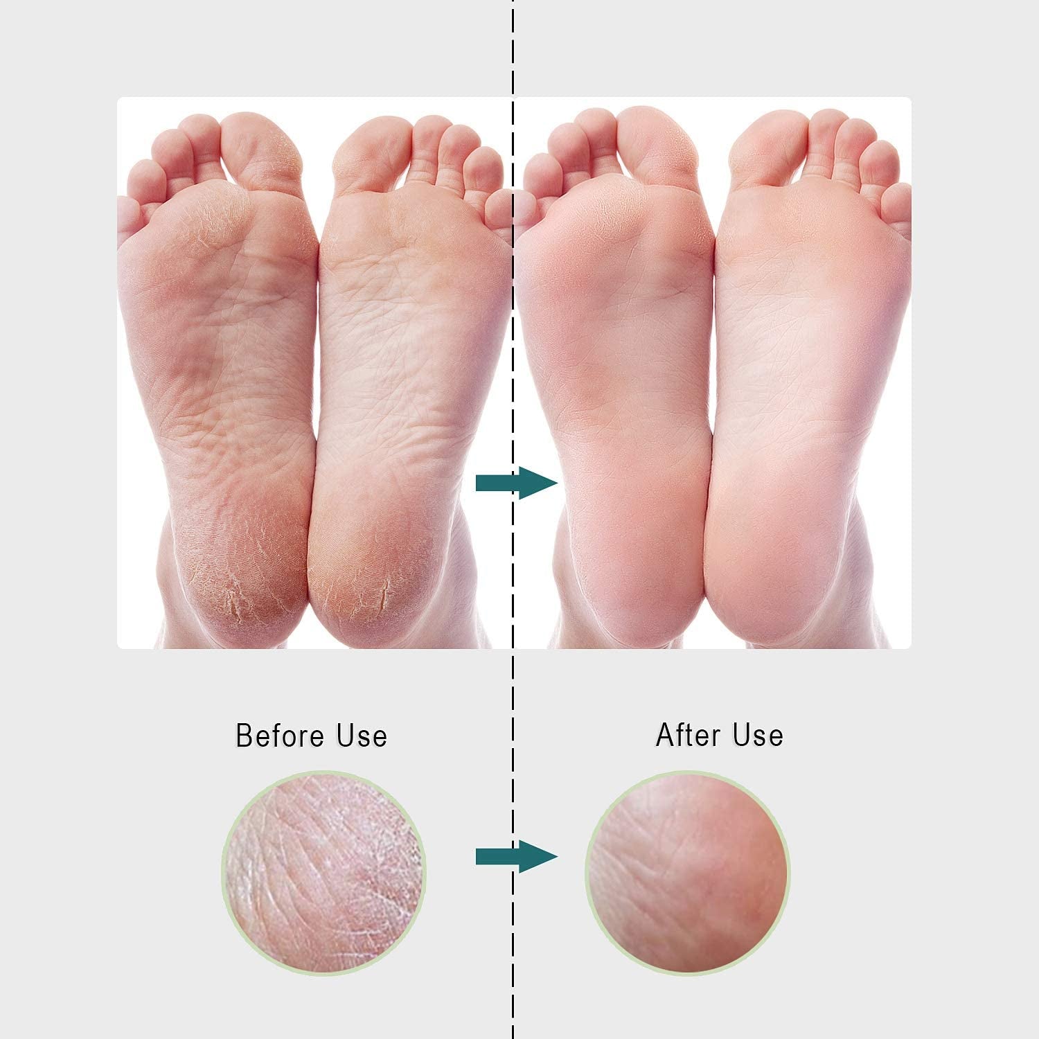 Lanvier Foot File Rasp Kits Professional Pedicure Tools to Remove Callus, Dead Skin and Other Foot Care for Women Men Home Health & Beauty > Personal Care > Foot Care Lanvier   