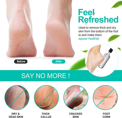 3Pcs Foot Files for Pedicures, 2 Stainless Steel Foot File Graters with an Extra Strong Removable Frame and a 2 Sided Foot File. Great Foot Care Products to Make Your Feet Look Healthy &Feel Refreshed Health & Beauty > Personal Care > Foot Care Capspace   