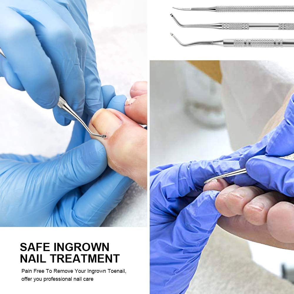 3Pcs Ingrown Toenail Tool, Toenail File and Lifters, [ Upgraded ] Teenitor Professional Surgical Safe Nail Treatment Pedicure Tool Kit under Nail Cleaner Tools Pain Relief Health & Beauty > Personal Care > Cosmetics > Cosmetic Tools > Nail Tools Teenitor   