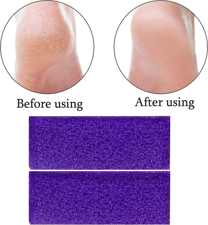 40 Pcs Pumice Stone for Feet Foot Scrubber Sponge for Feet Care and Callus Remover Mini Disposable Pumice Pads for Dead Skin Remover (Purple) Health & Beauty > Personal Care > Foot Care Tailpa   