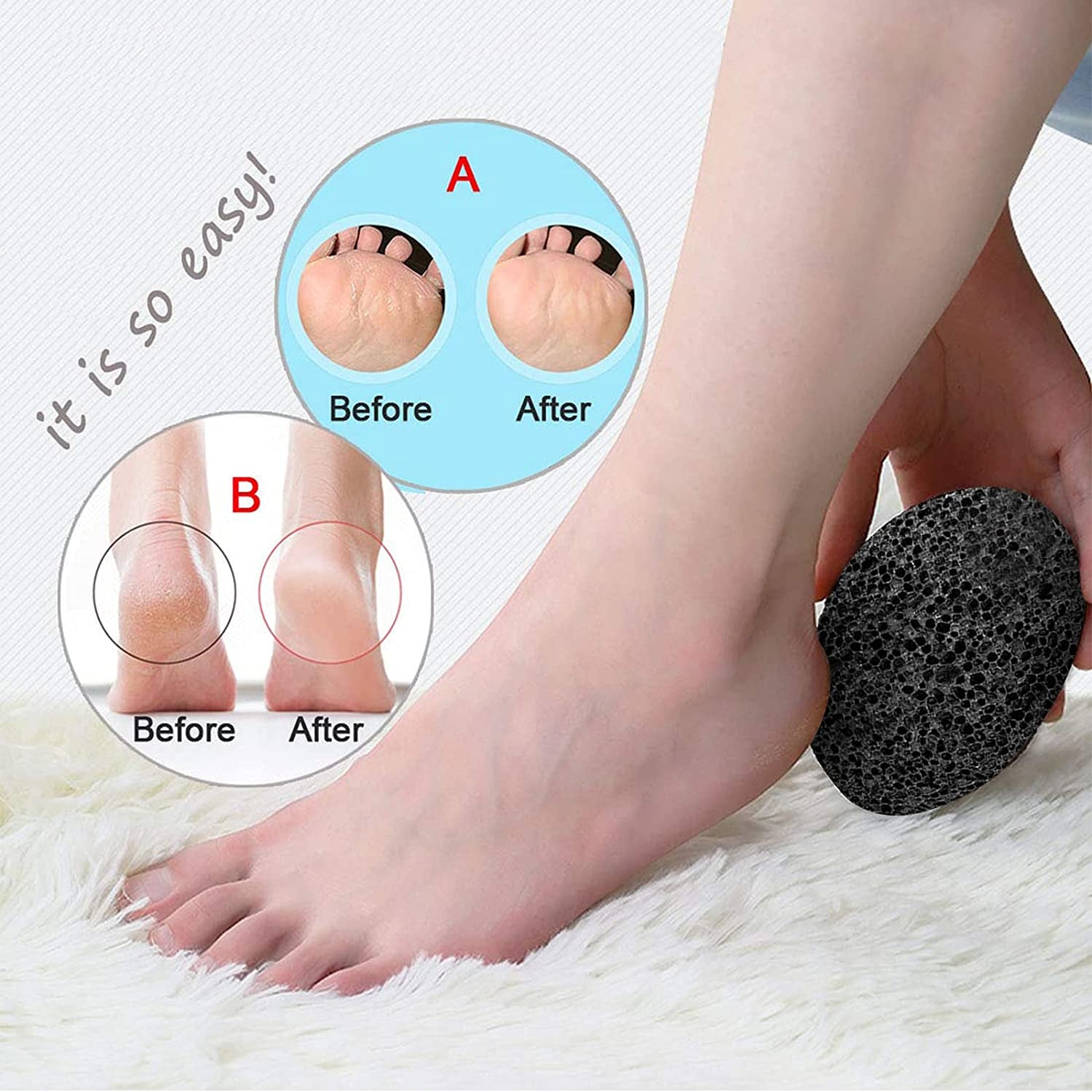 Symlis Natural Pumice Stone for Feet - Lava Callus Remover Feet - Health Foot Care - Pedicure Exfoliation Tool - Great for Corn Dead Skin Remover for Feet and Hands (2 Packs) Health & Beauty > Personal Care > Foot Care Symlis   
