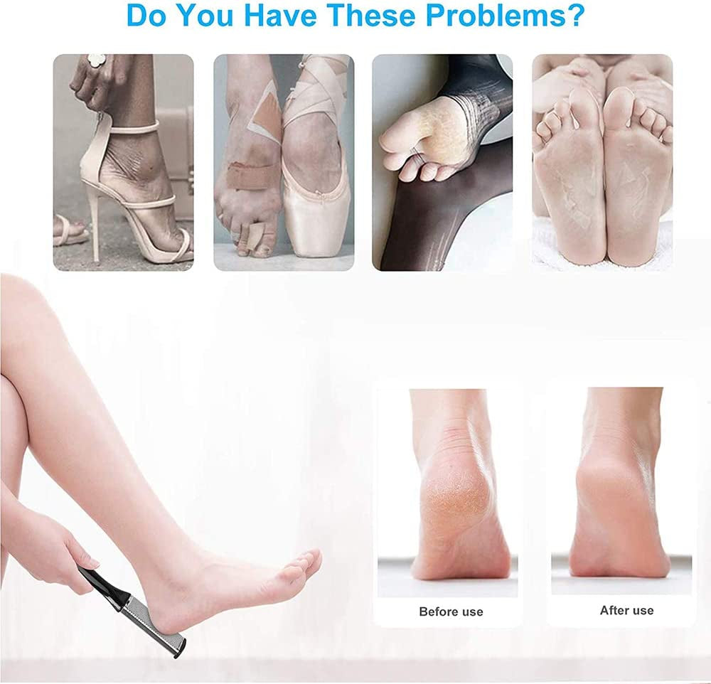 Professional Pedicure Tools Kit 20 in 1, Bagvhandbagro Foot Care Kit with Foot File Foot Rasp Scraper Dead Skin Remover Callus Scrubber Pedicure Tools for Men Women Christmas Gifts Health & Beauty > Personal Care > Foot Care Bagvhandbagro   