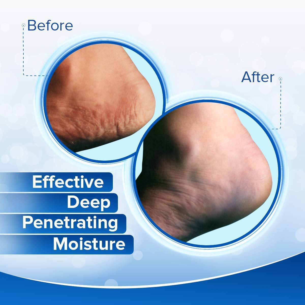 Dermal Therapy Heel Care Cream - Moisturizing Treatment That Repairs and Heals Dry, Rough, Cracked Heels and Feet | 25% Urea and 6% Alpha Hydroxy Acids (3 Ounce) | Packaging May Vary Health & Beauty > Personal Care > Foot Care Dermal Therapy   