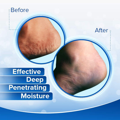 Dermal Therapy Heel Care Cream - Moisturizing Treatment That Repairs and Heals Dry, Rough, Cracked Heels and Feet | 25% Urea and 6% Alpha Hydroxy Acids (3 Ounce) | Packaging May Vary Health & Beauty > Personal Care > Foot Care Dermal Therapy   