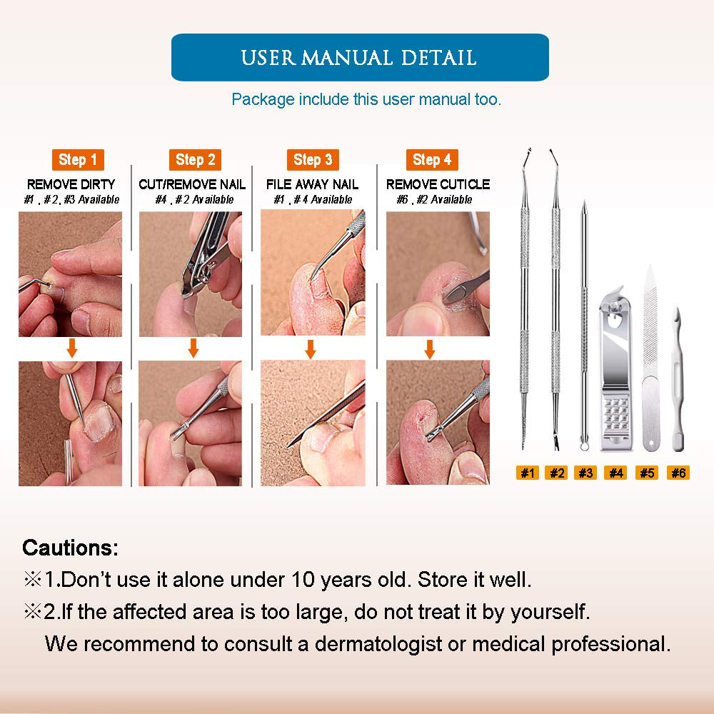 Premium 6PCS Ingrown Toenail Tools, Nail File and Lifter, Foot Nail Treatment Tool, Toe Nail Removal Clippers, Upgraded Stainless Steel, Professional Pedicure Tools, with Nail Cutter Trimmer Health & Beauty > Personal Care > Cosmetics > Cosmetic Tools > Nail Tools USCOLOR   