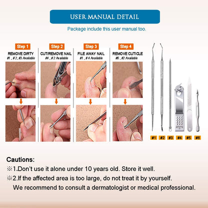 Premium 6PCS Ingrown Toenail Tools, Nail File and Lifter, Foot Nail Treatment Tool, Toe Nail Removal Clippers, Upgraded Stainless Steel, Professional Pedicure Tools, with Nail Cutter Trimmer Health & Beauty > Personal Care > Cosmetics > Cosmetic Tools > Nail Tools USCOLOR   