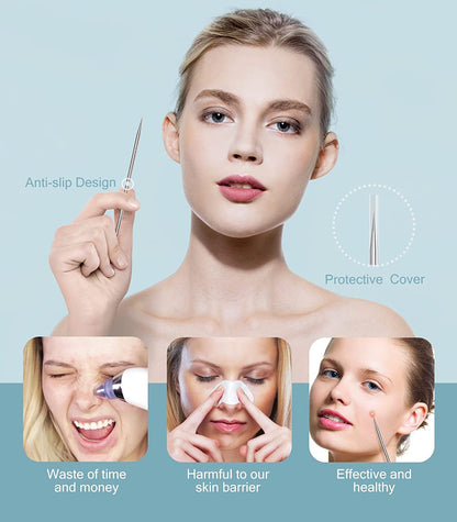 Pimple Popper Tool Kit, Upmore 6PCS Blackhead Remover Professional Stainless Acne Blemish Comedone Extractor Removal Tools with Metal Case and Tweezers for Whitehead Acne on Nose Face Health & Beauty > Personal Care > Cosmetics > Cosmetic Tools > Skin Care Tools Upmore   