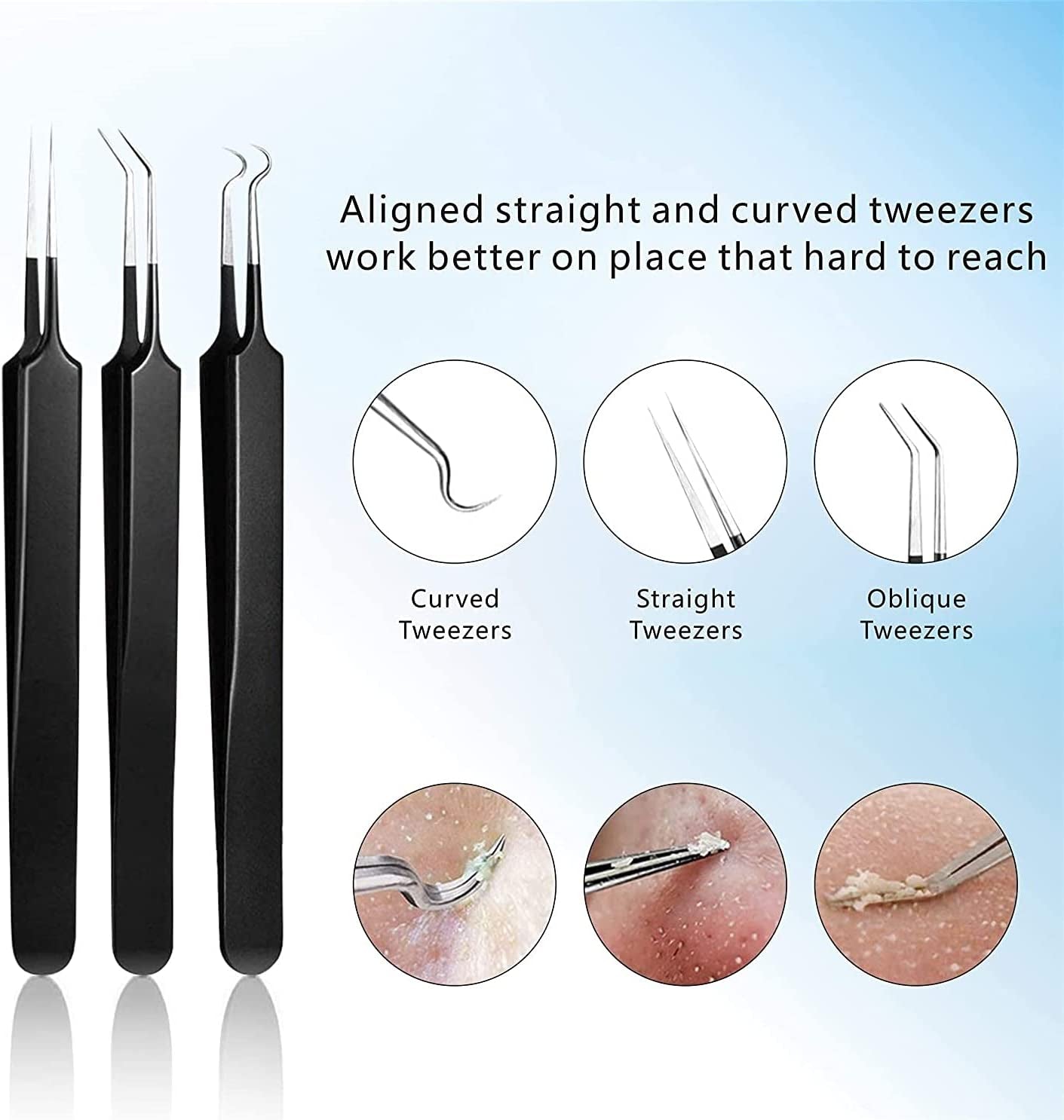 Pimple Popper Tool Kit 11 Pcs, Ybaoo Blackhead Remover Pimple Extractor Tools with Metal Case for Quick and Easy Removal of Blackheads,Pimples,Whiteheads,Zit Popper,Forehead,Facial and Nose (Black) Health & Beauty > Personal Care > Cosmetics > Cosmetic Tools > Skin Care Tools Ybaoo   