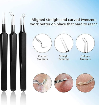 Pimple Popper Tool Kit 11 Pcs, Ybaoo Blackhead Remover Pimple Extractor Tools with Metal Case for Quick and Easy Removal of Blackheads,Pimples,Whiteheads,Zit Popper,Forehead,Facial and Nose (Black) Health & Beauty > Personal Care > Cosmetics > Cosmetic Tools > Skin Care Tools Ybaoo   