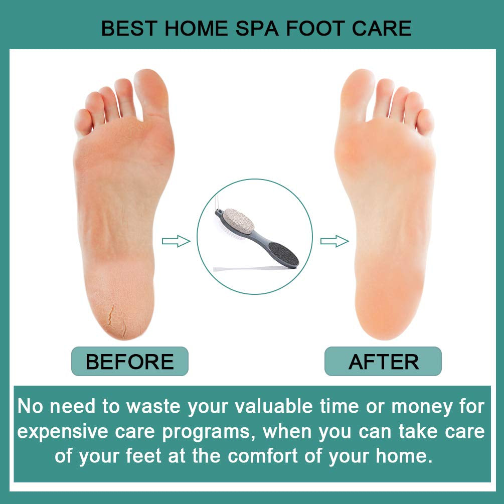 CAREHOOD Foot File Callus Remover - Multi Purpose 4 in 1 Feet Pedicure Tools with Foot Scrubber, Pumice Stone, Foot Rasp and Sand Paper for Home Foot Care (Grey Pedicure Foot File) Health & Beauty > Personal Care > Foot Care CAREHOOD   