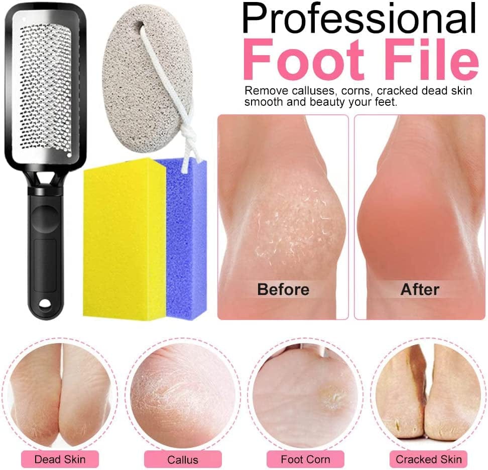 5 in 1 Professional Pedicure Kit, Stainless Steel Heel Scraper for Women Feet Care, Foot Pumice Stone for Feet Hard Skin Remover in Shower, Pumice Stone and Brush for Feet Callus Removal at Home/Salon Health & Beauty > Personal Care > Foot Care Spaidoon   