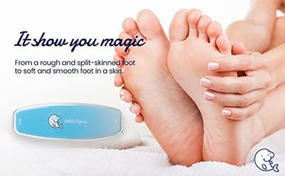 WHITE DUGONG Glass Foot File – Hard Dead Corn Skin Callus Remover Nano Scrubber Rasp Feet Care Pedicure Remove Cracked Heels Professional Tool Made in Korea Mint Health & Beauty > Personal Care > Foot Care WHITE DUGONG   