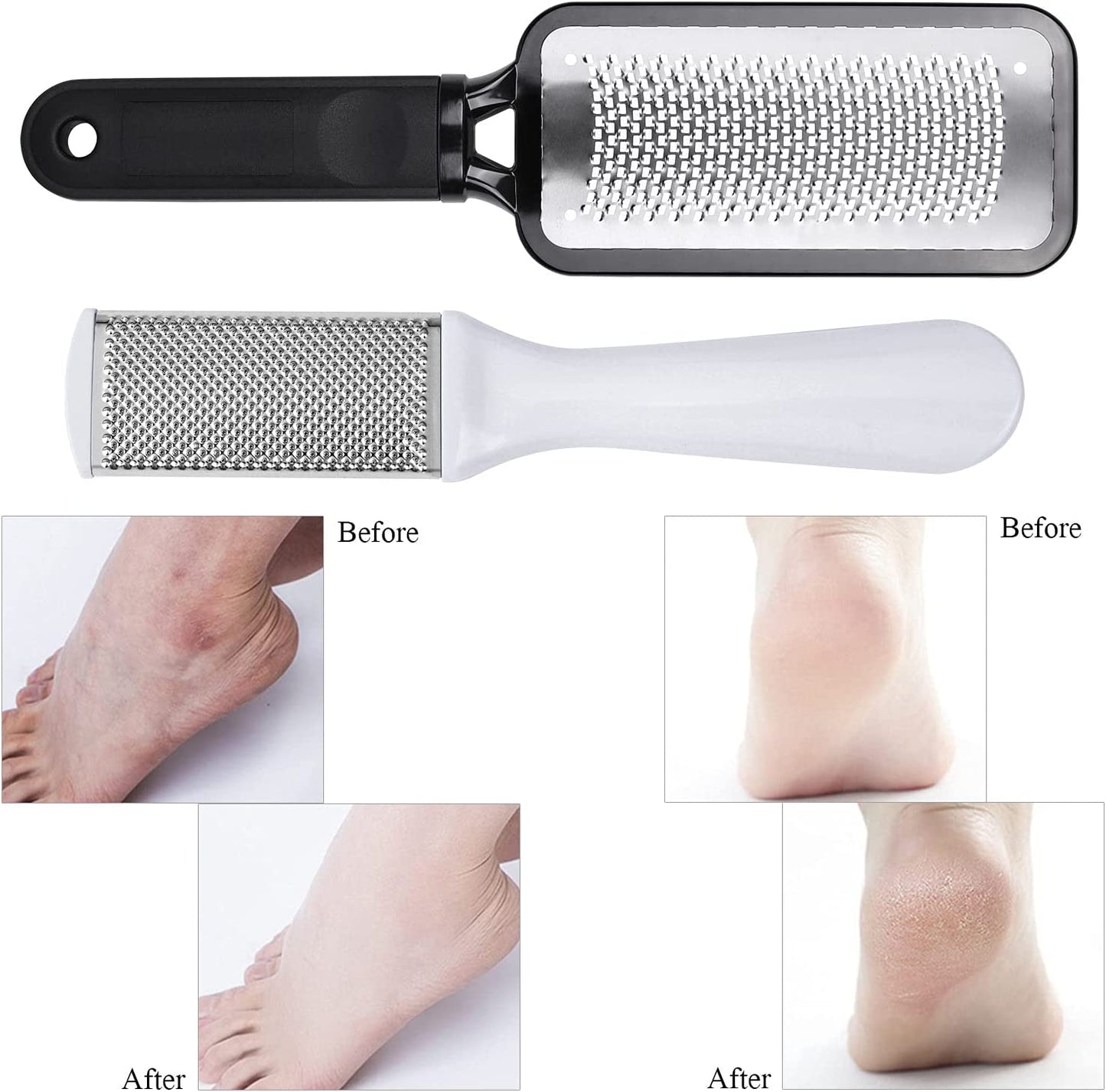 Foot Files Heel Callus Remover, 3 Pcs Professional Foot Care Pedicure Stainless Steel Rasp File for Wet and Dry Feet Health & Beauty > Personal Care > Foot Care LoveBB   