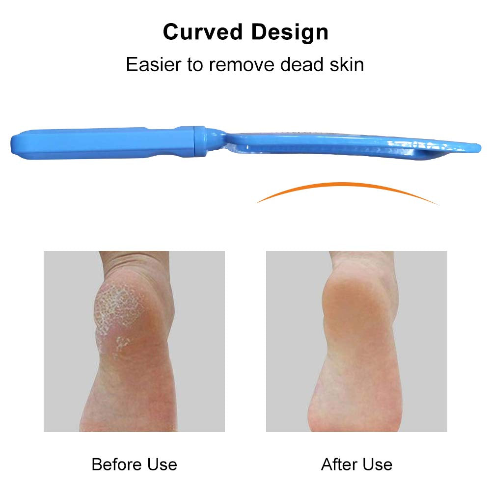 Foot File Callus Remover for Feet Heel Scraper for Feet Professional Foot Care in Pedicure Tools to Remove Dead Skin,Foot Scraper Available for Dry and Wet Feet,Stainless Steel Surgical Grade File Health & Beauty > Personal Care > Foot Care Duyoku   