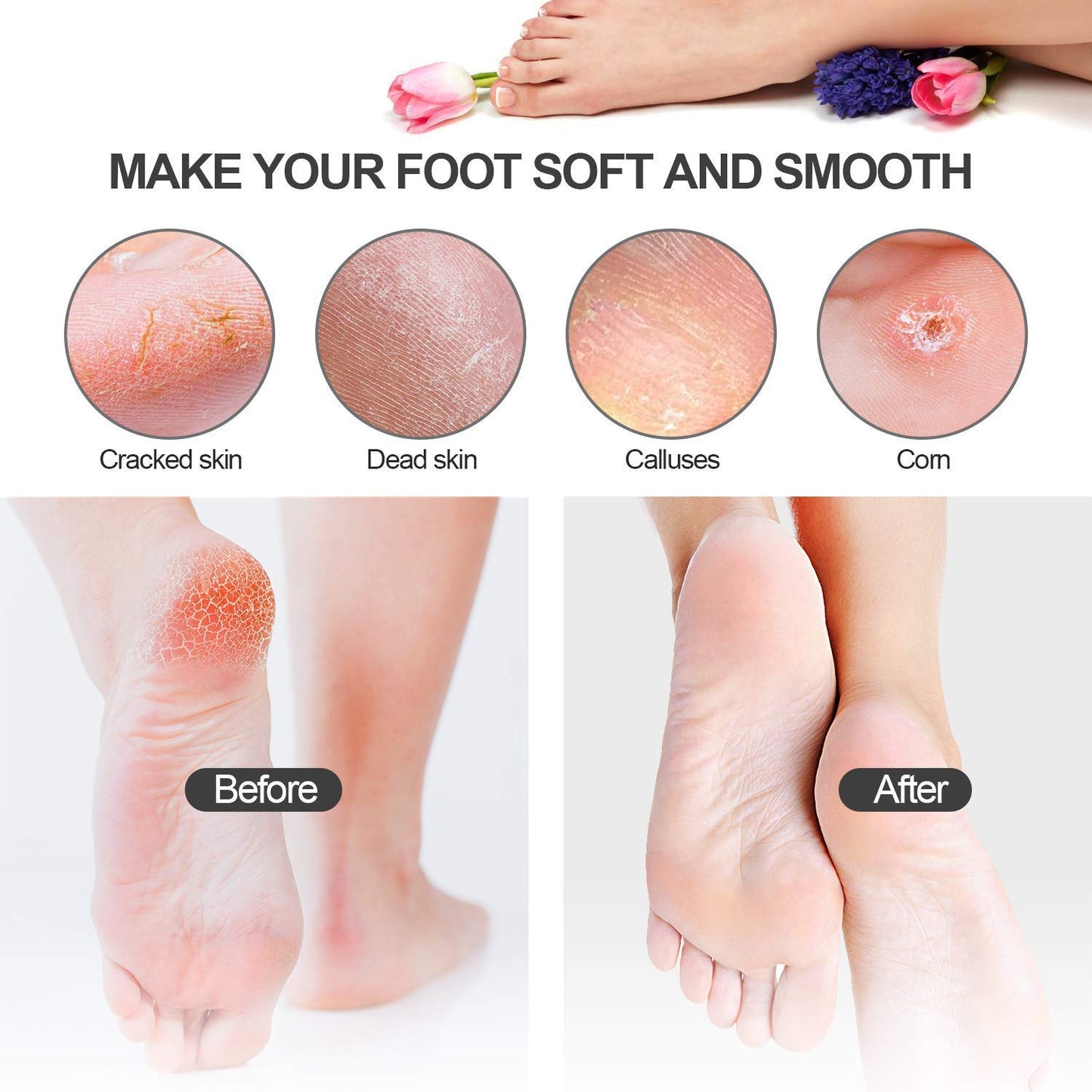 Manords 20 in 1 Professional Pedicure Kit, Pedicure Tools Set Foot Scrubber Dead Skin Remover Foot Care Kit for Women Men Salon or Home 33 Health & Beauty > Personal Care > Foot Care Manords   