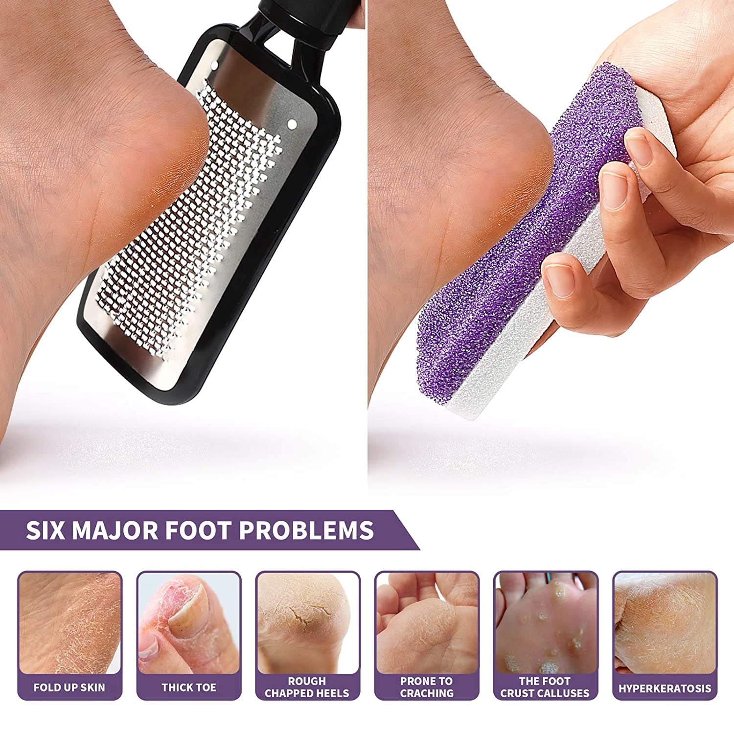 SWEHOME Colossal Professional Feet Care Pedicure Kit Scrubber Foot File and 2 in 1 Pumice Stone for Foot Callus Remover for Rough, Dead Skin Removal, Callus and Daily Feet Care Health & Beauty > Personal Care > Foot Care SWEHOME   