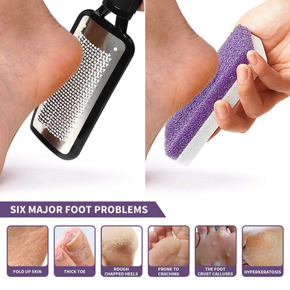 SWEHOME Colossal Professional Feet Care Pedicure Kit Scrubber Foot File and 2 in 1 Pumice Stone for Foot Callus Remover for Rough, Dead Skin Removal, Callus and Daily Feet Care Health & Beauty > Personal Care > Foot Care SWEHOME   
