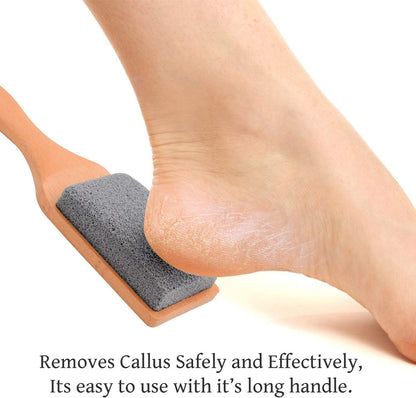 Professional Pedicure Foot File, Foot File Rasp, Callus Remover, Foot Scrubber - Perfect Foot Care for Cracked Heels - Corn Remover/File - Pedicure Tools, Heel Scraper File Health & Beauty > Personal Care > Foot Care Distributed by Miliamp   