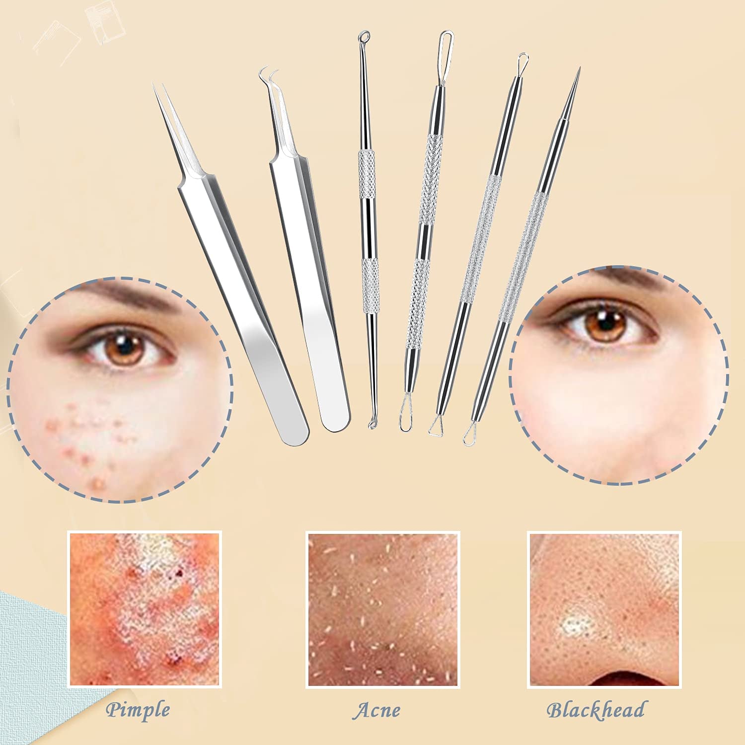 Blackhead Remover Pimple Popper Tool Kit, 6-In-1 Blackhead Comedone Acne Blemish Pimple Extractor Tool Kit Tweezers Kit Skin Care Tools for Face Health & Beauty > Personal Care > Cosmetics > Cosmetic Tools > Skin Care Tools SKINOSM   