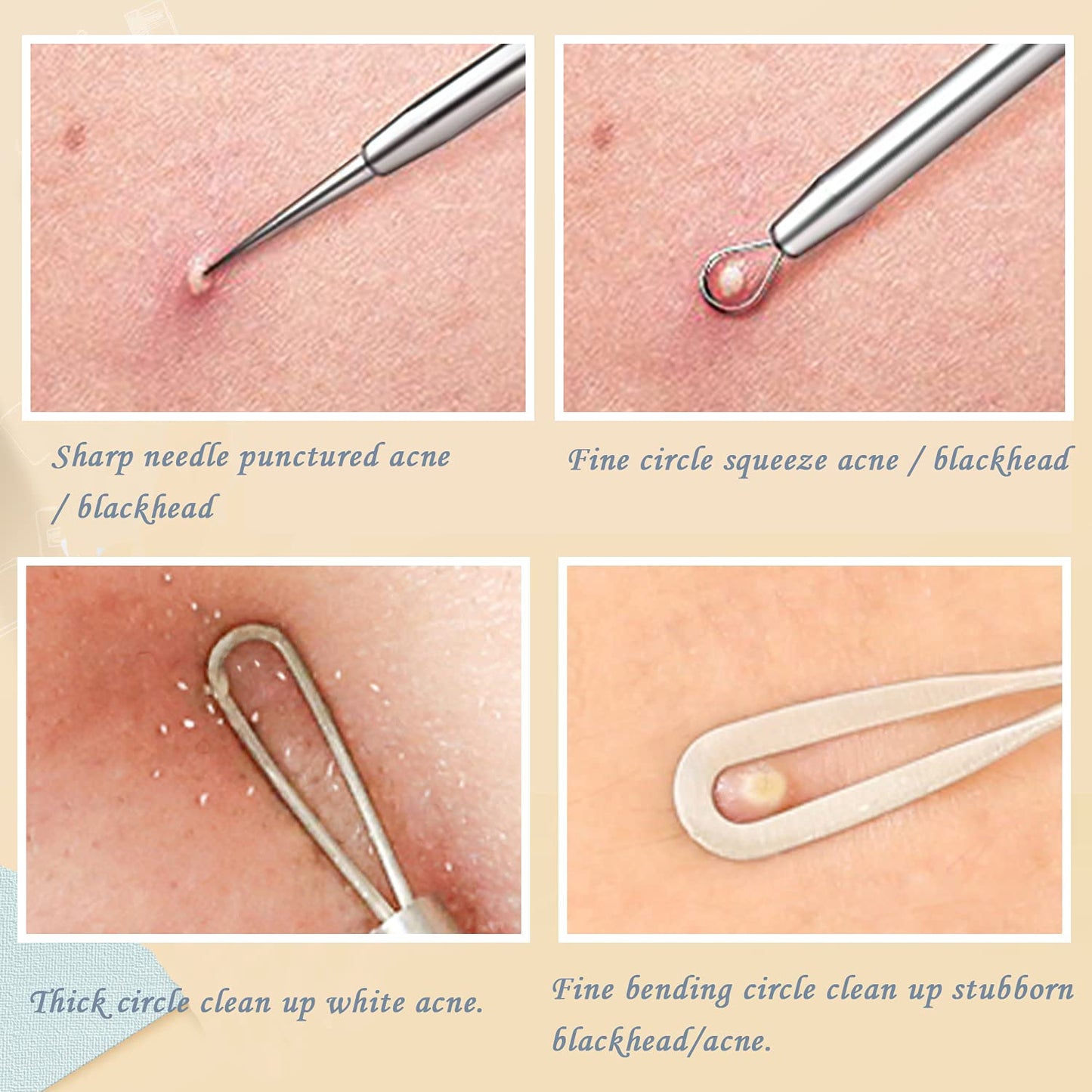 Blackhead Remover Pimple Popper Tool Kit, 6-In-1 Blackhead Comedone Acne Blemish Pimple Extractor Tool Kit Tweezers Kit Skin Care Tools for Face Health & Beauty > Personal Care > Cosmetics > Cosmetic Tools > Skin Care Tools SKINOSM   