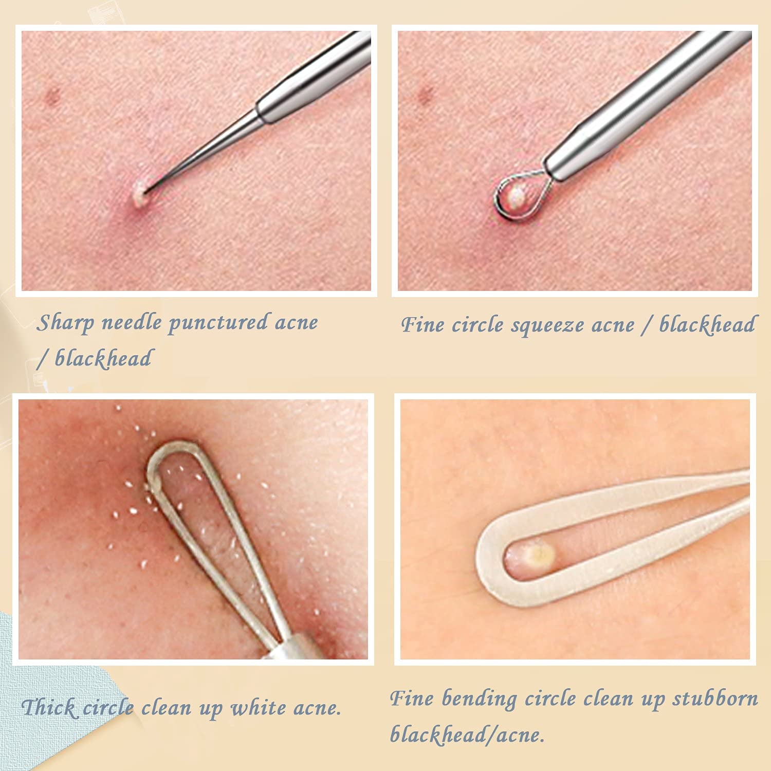 Blackhead Remover Pimple Popper Tool Kit, 6-In-1 Blackhead Comedone Acne Blemish Pimple Extractor Tool Kit Tweezers Kit Skin Care Tools for Face Health & Beauty > Personal Care > Cosmetics > Cosmetic Tools > Skin Care Tools SKINOSM   
